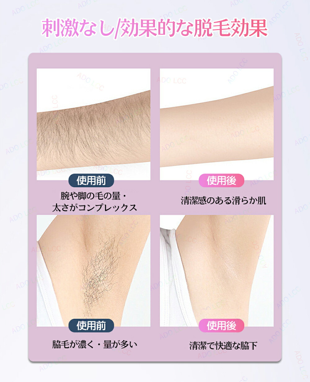 脱毛・除毛 es-clv5u 脱毛・除毛 es-clv5u 脱毛・除毛 es-clv5u ZX