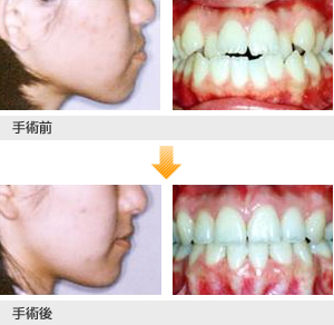 保険診療】顎変形症治療 | 診療科・部門 | 済生会横浜市南部病院