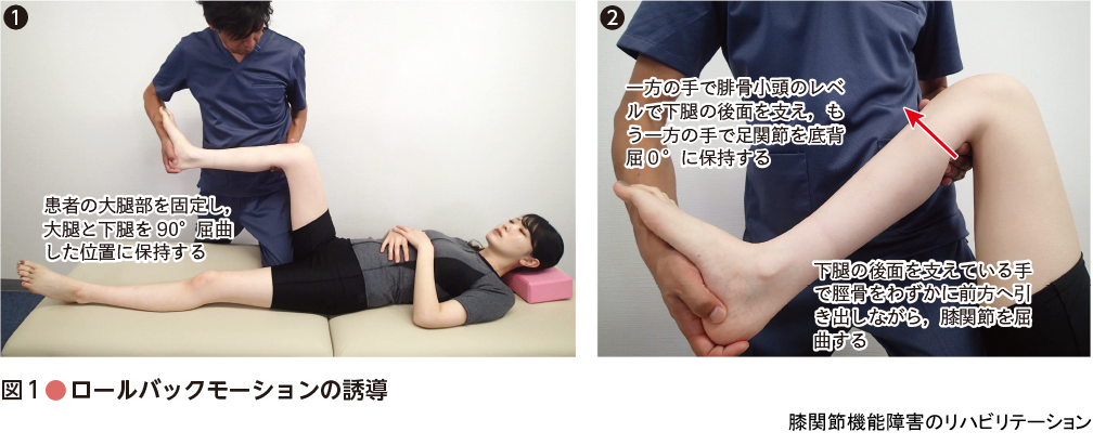 痛みの理学療法シリーズ：膝関節機能障害のリハビリテーション - 羊土社