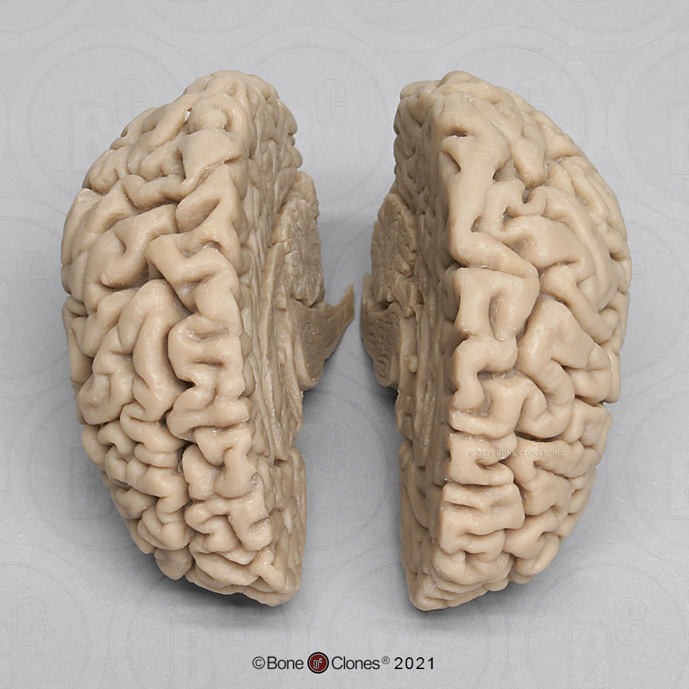 Human Brain - Bone Clones - Osteological Reproductions