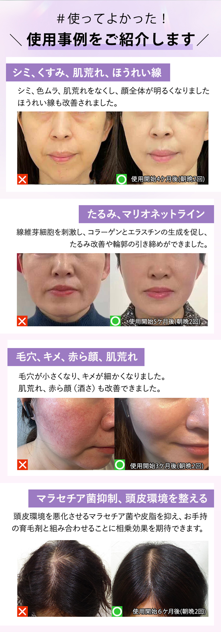 商品詳細 【ポーチ付き】プラズマエアーシャワー美顔器Un（アン）-UN01