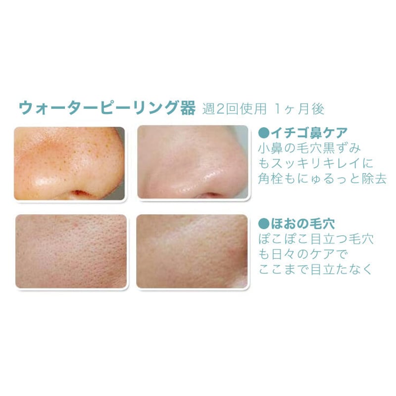 毛穴ケア美顔器 ウォーターピーリング器 | オーシャンブルー公式通販