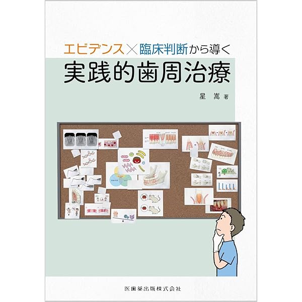 インプラント周囲炎を紐解く: 診断・予防・管理のすべて | Alberto