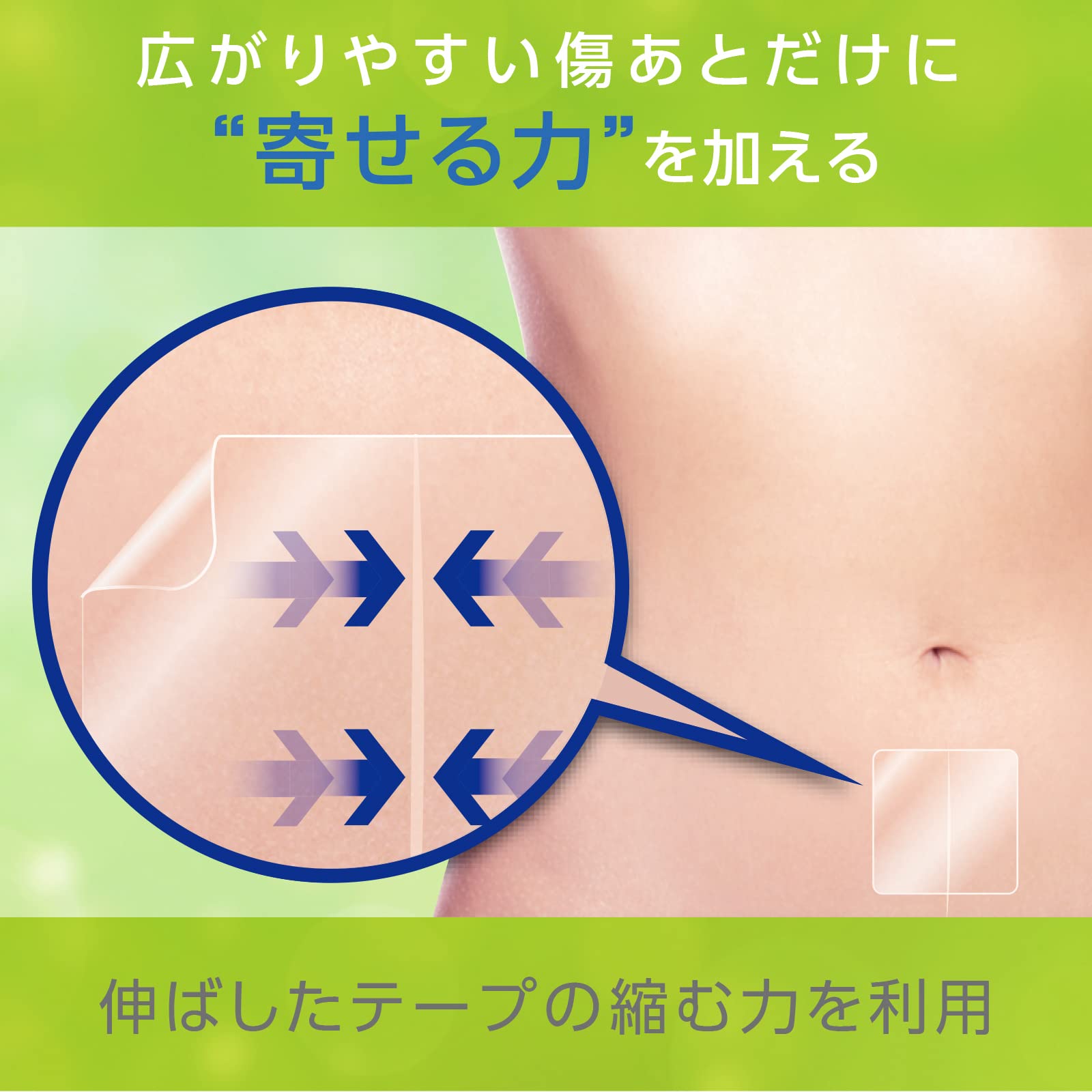 Amazon.co.jp: skinix アトレスケア 傷あとケア専用テープ 50×50mm 30