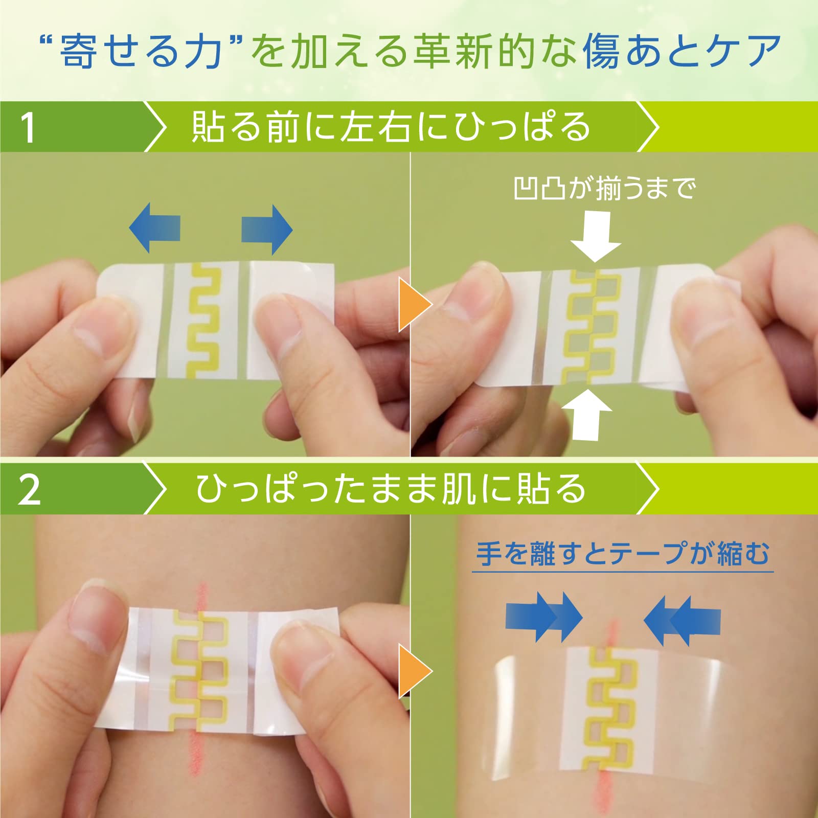 Amazon.co.jp: skinix アトレスケア 傷あとケア専用テープ 50×50mm 30