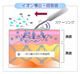 エレクトロポレーション | 症状について | ももだに皮ふ科クリニック