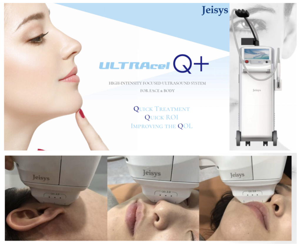 HIFU照射 ウルトラセルQプラス | Rパークサイド皮ふ科 | 福岡市中央区