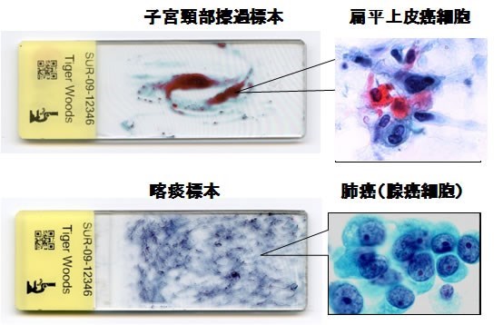 細胞検査士｜職業紹介｜大阪大学拠点がんプロフェッショナル養成プラン